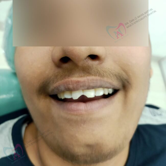 dr akhil mittal dental clinic